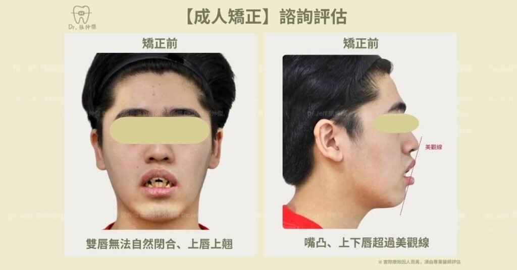 4 1【成人矯正】諮詢評估