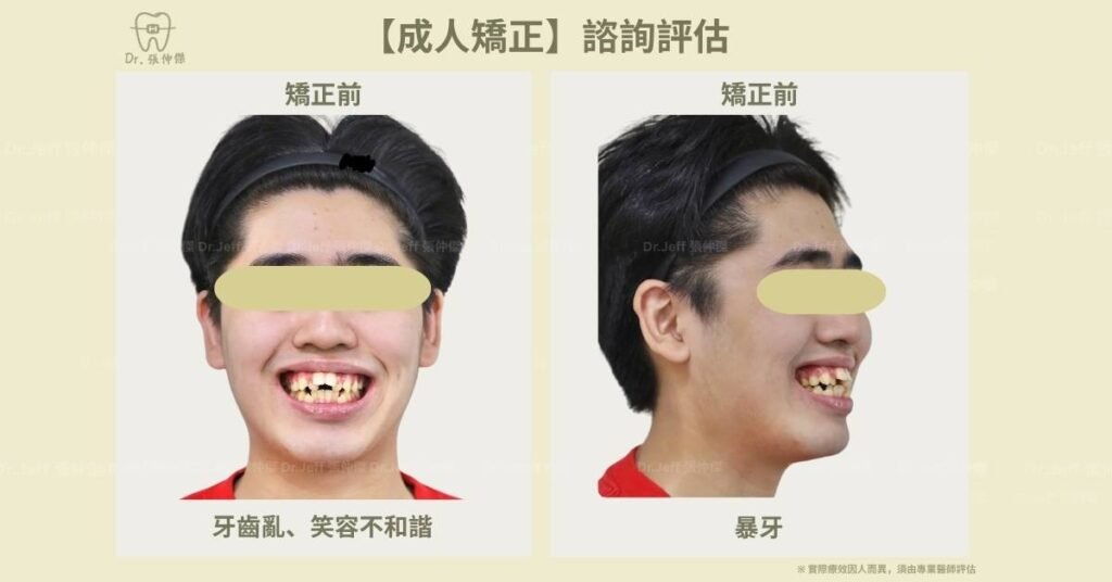 4 2【成人矯正】諮詢評估