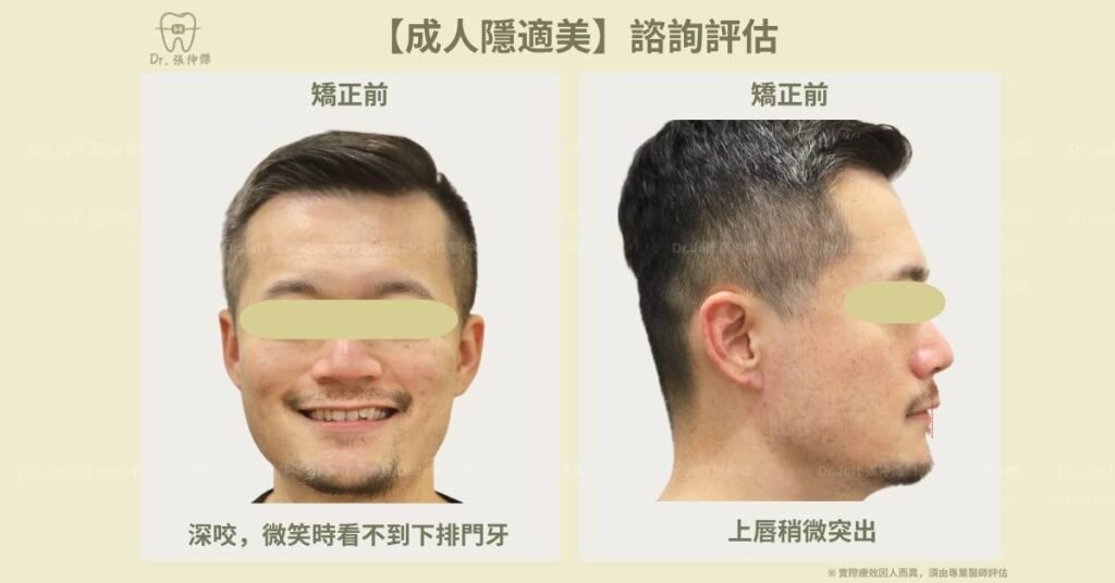 5 2【成人矯正】諮詢評估