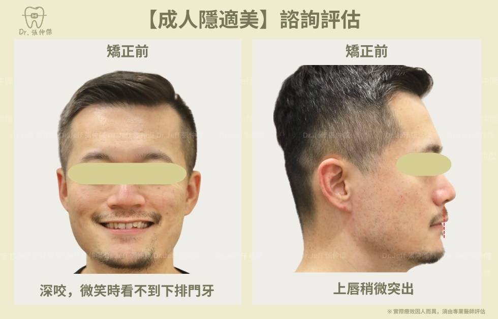 手機 5 1【成人隱適美】諮詢評估